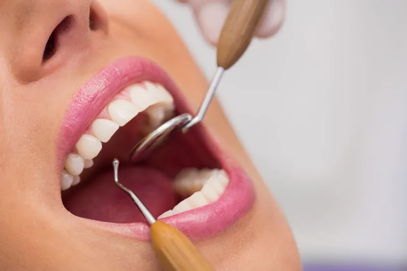 Hapvida +Odonto oferece saúde bucal como pilar do bem-estar integral todos os dias do ano